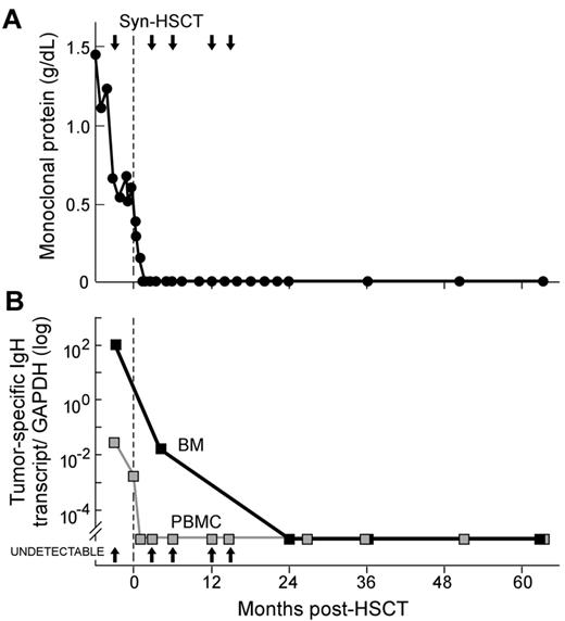 Figure 1. Achievement of durable molecular remission after syngeneic HSCT for treatment of MM in patient A. (A) Levels of serum monoclonal protein (g/dL) become undetectable by 1.5 months after HSCT. Arrows indicate the time points screened by protein microarray. Vertical dashed line indicates time of syngeneic stem cell infusion. (B) Expression of transcripts containing the IgH sequence unique to patient A's tumor is detectable by quantitative real-time PCR in BMMCs (black squares and solid line) and PBMCs (gray squares and line) before syngeneic HSCT, but is undetectable beginning at 24 months after HSCT. Values shown are tumor-specific IgH transcripts normalized to GAPDH transcript expression. “Undetectable” indicates samples with acceptable GAPDH values but absent tumor-specific IgH transcript expression.