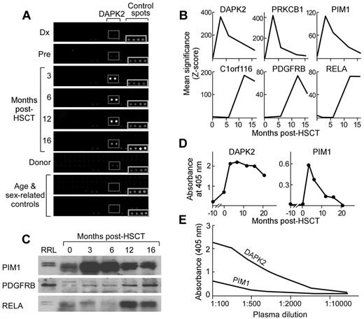 Figure 2. Serologic screening identifies high-titer Ab responses against DAPK2, PDGFRB, PIM1, and PRKCB1 developing after syngeneic HSCT. (A) Plasma samples collected from patient A at serial time points before and after HSCT were screened by ProtoArray protein microarray. Subarrays demonstrating DAPK2 reactivity are highlighted in the gray boxes. Spots seen in the bottom right corner of all subarray images are control spots. (B) Arrays were analyzed using 2 methods described previously.48 Six Ags, DAPK2, PDGFRB, C1orf116, RELA, PIM1, and PRKCB1, elicited significantly greater reactivity after HSCT compared with before HSCT. Significance (Z-scores) scores of Ab reactivity at time points are shown. (C) Ag binding was confirmed by immunoprecipitation of biotinylated target Ags expressed in vitro in rabbit reticulocyte lysate by patient plasma at serial time points. Immunoprecipitated Ags were detected using streptavidin-conjugated secondary Ab. Representative Western blots are shown. The first lane is whole rabbit reticulocyte lysate expressing target Ags that was not subjected to immunoprecipitation. (D) Plasma samples (1:200 dilution) collected from patient A at serial time points before and after HSCT were tested by ELISA (plates coated with 5 μg/mL of recombinant protein). Ab IgG responses against DAPK2 and PIM1 arose and peaked at 3 months after HSCT. (E) Candidate Ags elicit high-titer Ab responses, as indicated by titration studies of serum using ELISA assays. Reactivity remained detectable at dilutions of 1:10 000 (DAPK2) and 1:5000 (PIM1).