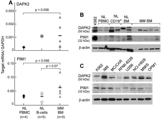 Figure 3. Expression of DAPK2 and PIM1 is enriched in primary MM cells. (A) DAPK2 and PIM1 have high transcript expression in primary MM BMMCs (gray triangles), but not in normal PBMCs (black diamonds) by gene-specific quantitative real-time PCR. BM specimens contained > 95% tumor by immunohistochemistry. DAPK2, but not PIM1, was also highly expressed in normal CD19+ B cells (white squares). Bars indicate the median value for transcript expression relative to GAPDH. Statistical significance was determined by 1-sided exact Wilcoxon rank-sum test. (B) Western blotting of cell lysates (20 μg of protein per lane) from normal hematopoietic cells and primary MM BMMCs with Ab against either DAPK2 or PIM1 reveals protein expression in 4 (DAPK2) or 3 (PIM1) of 5 primary MM BMMCs. (C) Western blotting of MM cell line lysates (20 μg of protein per lane) showed expression of DAPK2 and PIM1 in all tested MM cell lines.