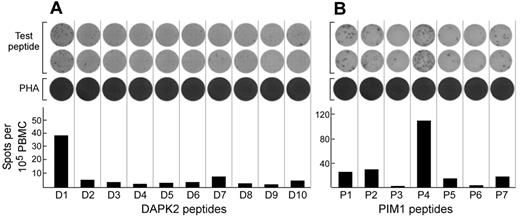 Figure 5. DAPK2- and PIM1-derived nonameric peptides elicit T-cell reactivity in post-HSCT PBMCs from patient A. Fresh post-HSCT PBMCs were stimulated ex vivo with 10μM concentrations of individual peptides in the presence of 10 μg/mL of IL-7 for 7 days, then tested by ELISpot with peptide-pulsed autologous matured dendritic cells (PBMC:APC ratio = 1:1). (A) T cells from patient A 2.5 years after HSCT show reactivity to the DAPK2-derived peptide D1, but not to other DAPK2-derived peptides. (B) T cells from patient A 2.75 years after HSCT are strongly reactive to the PIM1-derived peptide P4 and weakly reactive to P1, P2, P5, and P7.