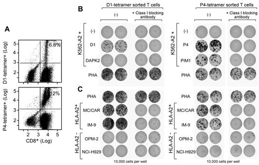 Figure 6. D1- and P4-specific T cells are isolated by tetramer sorting and recognize whole processed and presented Ag. (A) Patient A CD3+ T cells were repeatedly stimulated with either D1 or P4 peptide-pulsed T2 cells before staining with peptide-specific tetramer. Tetramer and CD8 double-positive cells were isolated by FACS (representative FACS plots shown). (B) Sorted D1- or P4-positive T cells were tested by ELISpot against K562 cells stably transfected to express HLA-A2 (K562/A2 cells) that were nucleofected to overexpress either DAPK2 or PIM1. As expected, overexpression of DAPK2 induced apoptosis in nucleofected K562 cells.24 P4-specific T cells recognized processed and presented PIM1, an effect that was blocked by the class I–blocking Ab w6/32. (C) Sorted D1- or P4-positive T cells were also tested against the A2-positive MM cell lines MC/CAR and IM9 and the A2-negative MM cell lines OPM2 and NCI 4929. Both D1- and P4-specific T cells showed reactivity to HLA-A2–positive cell lines, but not to HLA-A2–negative cell lines. IFN-γ secretion was blocked by co-incubation with w6/32 Ab.