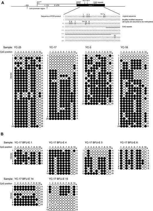 Figure 3. Patterns of CpG methylation of the human androgen receptor gene HUMARA by bisulfite sequencing. (A top) Diagram of the 5′ region of the human androgen receptor gene showing the locations of core promoter region, transcription start site (+1), translation start site (ATG), and methylation-sensitive enzyme sites for HpaII. Specific CpG dinucleotides in exon1 region are highlighted in the sequence of PCR product. (down) The sequencing results of the PCR products of the exon 1 HUMARA gene in native selected granulocytes. Total 20-29 clones were analyzed from healthy controls YC25, YC17, YC3, and YC18, respectively. The white dots represent the unmethylated CpGs, whereas black dots represent the methylated CpGs. Short allele (A) and long allele (B) were determined according to the length of the AR gene exon 1 microsatellite. (B) Patterns of CpG methylation of the human androgen receptor gene HUMARA by bisulfite sequencing in individual BFU-Es of subject YC17. The sequencing results of the PCR products of the exon 1 HUMARA gene. Total 6-10 clones were analyzed for BFU-E 1, BFU-E 2, BFU-E 3, BFU-E 4, BFU-E 5, and BFU-E 6, respectively. The white dots represent the unmethylated CpGs, whereas the black dots represent the methylated CpGs. Short allele (A) and long allele (B) were determined according to the length of the AR gene exon 1 microsatellite.