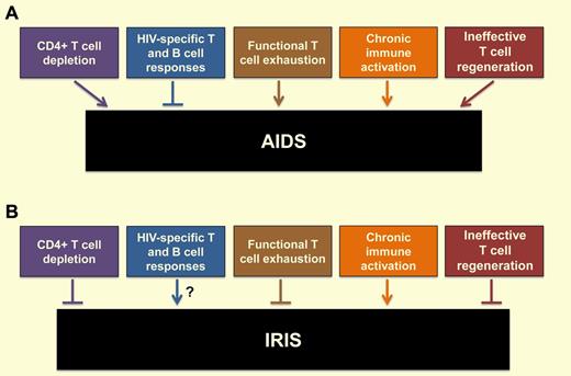 Consequences of HIV infection on the host immune system and how these features impact the development of (A) AIDS and (B) IRIS.