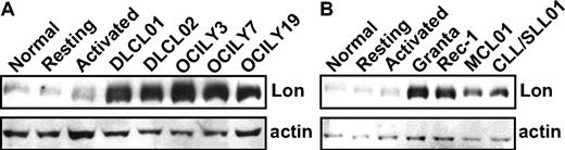 Figure 1. Lon is up-regulated in patient biopsy specimens and lymphoma cell lines compared with resting or activated normal peripheral blood B cells. Protein extracts (20 μg) obtained from cells as described in “Methods” and supplemental Methods, were immunoblotted with antibodies to Lon or actin. (A-B) Extracts from freshly isolated normal donor peripheral blood B cells that were positively selected using CD19+ magnetic beads (normal), as well as in normal B cells that had been cultured for 72 hours with activation of the TLR9 using CpG oligonucleotides, and the B-cell receptor using anti-IgM (activated), or untreated (resting). (A) Extracts from malignant DLCL cells from a patient splenectomy specimen (DLCL01) and DLCL cells from a malignant pleural effusion (DLCL-02), as well as in the diffuse large cell lymphoma (DLCL) cell lines OCI Ly-3, -7 and -19. (B) Extracts from Granta and Rec-1 MCL cell lines, MCL cells from a patient lymph node biopsy (MCL01) and in chronic lymphocytic leukemia (CLL)/small lymphocytic lymphoma (SLL) cells from a patient lymph node biopsy (CLL/SLL01).