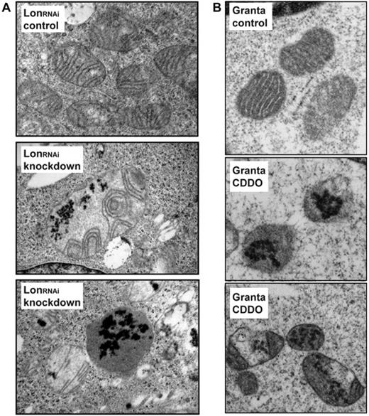 Figure 4. CDDO and Lon knockdown induce the accumulation of electron dense inclusions within mitochondria. (A) Mitochondria from LonRNAi cells, expressing Lon (control) or knocked down for Lon by doxycycline (DOX) treatment for 2.5 weeks. (B) Mitochondria from Granta cells cultured in the absence (control) or presence of CDDO (2.5μM) for 24 hours.