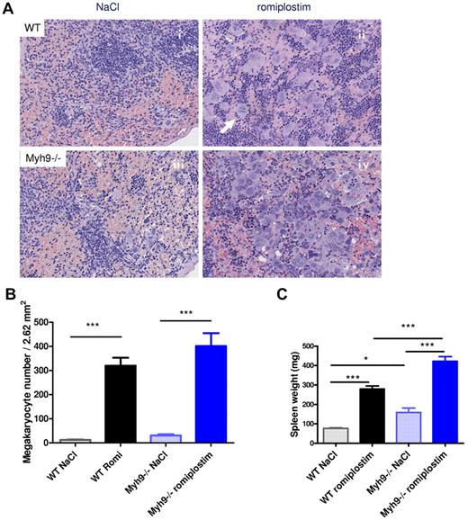 Figure 3. Romiplostim-induced increase in splenic MKs. (A) H&E-stained paraffin sections of the spleen of romiplostim-treated and control mice. Animals treated with romiplostim (ii,iv) show a clearly visible increase of MKs in the spleen compared with the untreated animals (i,iii). Of note, the number of MKs was already slightly increased in Myh9−/− mice at baseline (iii). The arrow in panel ii shows a mitosis of a MK (original magnification, ×789). (B) Quantification of MK numbers in the spleen (mean ± SEM of 9-10 animals per column). (C) Spleen weight; mean ± SEM of 9-10 animals per column.