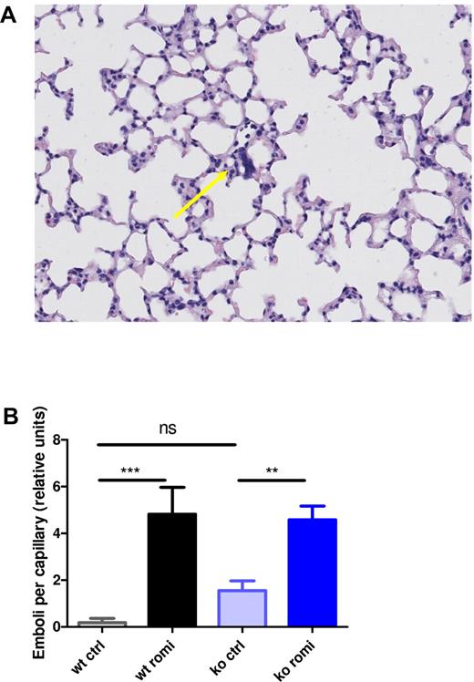 Figure 5. Romiplostim-induced increase in MK nuclei lung emboli. (A) H&E-stained lung tissue of a WT animal treated with romiplostim showing a representative lung embolus (arrow). (B) Quantification of the emboli per capillary in lung tissue. Each bar represents the mean ± SEM of 10 animals.