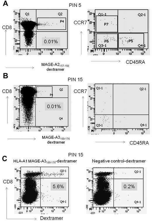 Figure 4. Ex vivo characterization of the MAGE T-cell response with the use of dextramers. (A-B) Ex vivo dextramer stain of patient PIN 5 (A) and PIN 15 (B) PBMCs counterstained with the MAGE-specific dextramer and anti-CCR7 and CD45RA Abs. (A) MAGE-A2157-166–specific dextramer stain from PIN 5, 12 months after transplantation. (B) MAGE-A3168-176–specific dextramer stain from PIN 15, 9 months after transplantation. (C) Expansion of the MAGE-A3168-176–specific CD8+ T-cell response from PIN 15 showing expansion by ∼ 500-fold (from 0.01% to 5.6% of CD8 T cells). The percentage of dextramer-positive T cells is displayed on the x-axis and CD8 is displayed on the y-axis. The other 2 patients studied, PIN 5 and PIN 11, showed 20-fold (0.2% of CD8+ T cells) and 30-fold (0.3% of CD8+ T cells) expansions, respectively (data not shown).