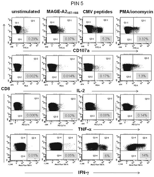 Figure 5. CD107a and intracellular cytokine staining of PBMCs from PIN 5 12 months after transplantation. PBMCs were stimulated for 5 hours with the tumor-specific peptide, left unstimulated or stimulated with CMV peptides or PMA/ionomycin as positive controls. The data show percentage of CD107a mobilization and IL-2, TNF-α, and IFN-γ secretion after stimulation with the relevant peptide.