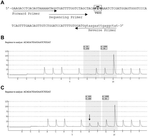 Figure 1. BRAF primer design and representative pyrograms. (A) The modified pyrosequencing assay design from Packham et al.16 The assay detects all mutations in codon 600, including the common V600E (c.1799T > A) mutation as well as the less common variant mutations involving codons 599 through 601. (B-C) Representative pyrograms from an HCLc-expressing IGHV4-34 (case BH18; 92.6% HCL cells) revealing a wild-type result at codon 600 (B), and from an HCLc (case BH21; 77.4% HCL cells) expressing IGHV5-51 showing the c.1799T > A (V600E) mutation (C). The nucleotides on the x-axis (beginning with G) represent their dispensation order during the pyrosequencing reactions, whereas the y-axis displays arbitrary units related to peak height. Peak heights are proportional to the number of nucleotides incorporated into the growing DNA strand. The shaded boxes represent the percentage of nucleotides calculated at a particular interrogated location (AQ score). The arrow in panel C indicates the c.1799T > A mutation. The shaded box represents an AQ score of 41% A and 59% T at that position.