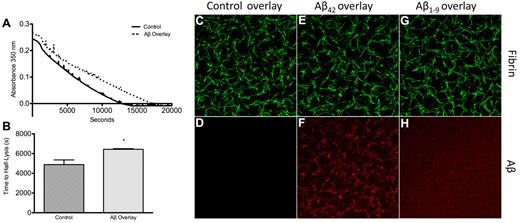 Figure 7. Preformed clots overlaid with Aβ are resistant to lysis and contain fibrin-bound Aβ. (A) Preformed clots (as described in “Clot turbidity analysis”) containing no Aβ were overlaid with 5μM Aβ42 (dashed line) or control buffer (solid line) for 1 hour, the overlays removed, and the clot surfaces washed. All clots were then overlaid with 10nM tPA to initiate lysis. (B) Half-lysis of clots that had been overlaid with Aβ was significantly delayed compared with control clots (P = .012). (C-H) Confocal microscopy of clots using Alexa Fluor 488–labeled fibrinogen and HiLyte Fluor-555–labeled Aβ prepared as described in “Aβ binding to fibrinogen.” (C-D) Normal clot overlaid with buffer. (E-F) Normal clot overlaid with 555-Aβ42 (3μM) for 1 hour contained fibrin-bound Aβ42 (G-H). Normal clot overlaid with 555-Aβ1-9 (3μM) for 1 hour did not show specific colocalization between fibrin and Aβ1-9. Images are representative of ≥ 3 experiments.