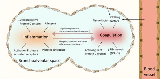 Figure 1. Interaction between coagulation and allergic inflammation in asthma. Coagulation is activated in the airways of patients with asthma by leak of clotting factors and TF expressed on various cell types, including alveolar epithelium, macrophages, and eosinophils. Fibrin deposition is further facilitated by decreased activity of the anticoagulant protein C system and inhibition of fibrinolysis by enhanced production of PAI-1. Allergens are responsible for an inflammatory response in the lungs, which is aggravated by proinflammatory effects of platelets and decreased cytoprotective effects of the PC system. PARs play an important role as the molecular link between coagulation and inflammation; these receptors are activated by proteases expressed by either allergens or factors involved the regulation of coagulation.