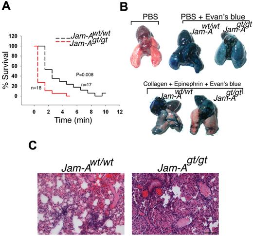 Figure 3. Absence of Jam-A accelarate pulmonary thromboembolism. (A) Survival curve of Jam-Awt/wt and Jam-Agt/gt mice after induction of pulmonary thromboembolism (n = 18). (B) Representative images of lung isolated from Jam-Awt/wt and Jam-Agt/gt injected with PBS or PBS and Evans blue or a mixture of collagen and epinephrine solution. (C) H&E-stained sections of lungs.