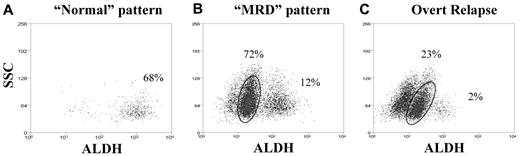 Figure 3. Staining patterns after therapy. Representative examples of (A) “normal” and (B) “MRD” staining patterns, as well as (C) overt clinical relapse. CD34+CD38− cells are shown by ALDH versus side scatter (SSC). (A) An AML patient (patient 17) with normal cytogenetics, in durable CR exhibiting the “normal” pattern with no detectable CD34+CD38−ALDHint population. The comparison diagnostic pattern for this patient is shown in Figure 1D. (B) An AML patient (patient 1) with Inv16 AML, demonstrating the “MRD” pattern while still in CR; the circled CD34+CD38−ALDHint population was 95% leukemic by FISH. The comparison diagnostic pattern is shown in Figure 1C. (C) A patient (patient 9) with t(8;21) AML, in overt relapse resembling the original diagnostic pattern (shown in Figure 1B). The percentages of CD34+CD38− cells composed of the CD34+CD38−ALDHint and CD34+CD38−ALDHhigh populations are listed on each dot plot.