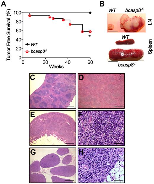 Figure 1. Deletion of casp8 in B cells leads to B-cell lymphomagenesis. (A) Kaplan-Meier analysis representing the percentage of tumor-free survival in cohorts of WT (n = 12) and bcasp8−/− (n = 31) mice. (B) Representative splenomegaly and lymphadenopathy displayed by bcasp8−/− sick mice. Bar indicates 1 cm. (C-D) H&E staining of the spleen of a bcasp8−/− sick mouse showing tumor cell infiltration predominantly affecting the red pulp. Bar indicates 500 μm. (E-F) H&E staining of intestine from a bcasp8−/− lymphoma bearing mouse. (E) Expansion of the Peyer patches, with thickening of the sub-mucosa and tumor invasion into the muscle layers and the mucosal lamina propria. Bar indicates 500 μm. (F) These tumors were composed of sheets of small lymphoid cells, many of which showed plasma cell phenotypes. Bar indicates 100 μm. (G-H) LNs infiltrated by tumors in which the normal architecture was partially or completely replaced by tumors and invading into the surrounding adipose tissue. Bar indicates 500 μm in panel G and 100 μm in panel H. *P = .01 for log-rank test between WT and bcasp8−/− curves.