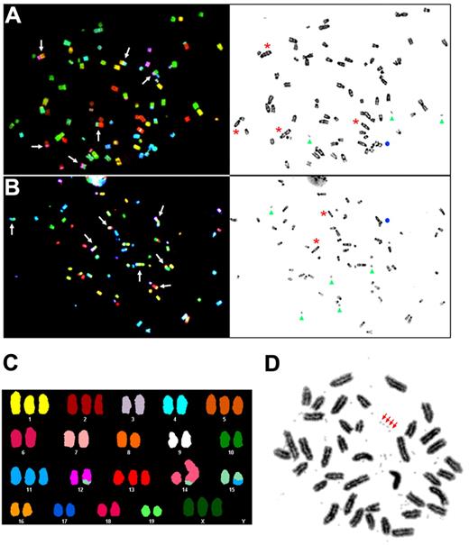 Figure 4. Elevated genomic instability in casp8-deficient B-cell lymphomas. (A-B) The genomic instability of bcasp8−/− B-cell lymphomas (A, tumor 1; and B, tumor 2) was examined by SKY. The left panels show metaphases hybridized with the SKY probe. The matching inverted DAPI staining is shown in the right panels. A multitude of numerical and complex structural rearrangements were observed: dicentric chromosome (*); acentric chromosome (arrowhead), triradial (●), and translocation (arrow). (C) Representative SKY karyotype of bcasp8−/−p53−/− tumors showing aneuploidy and chromosomal translocations (46,XX,+X,+1,+2,+5,+11,der(12)t(12;15)(D;F),+13,der(14)dup(14)(?)t(14;15)(E;F),der(15)t(11;15)(E1;D1). (D) Representative diploid metaphase of a lymphoma from bcasp8−/−p53−/− mice. The presence of numerous double-minute chromosomes is evident (representatives are indicated with arrows).