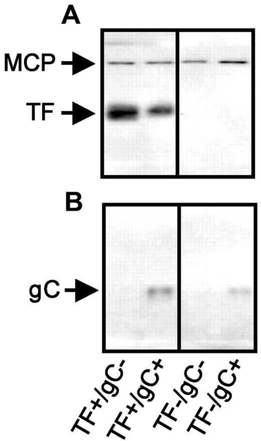 Figure 1. TF- and gC-restricted HSV1 panel. An equal number of purified virus particles (7.5 × 1010) were separated electrophoretically through a 10% polyacrylamide gel, followed by Western blot analysis. The presence of TF (A) and HSV1 gC (B) were detected by Western blot. HSV1 major capsid protein (MCP) was used as a virus particle loading control (co-blotted in panel A). Protein Ag identification was consistent with molecular weight markers (not shown).