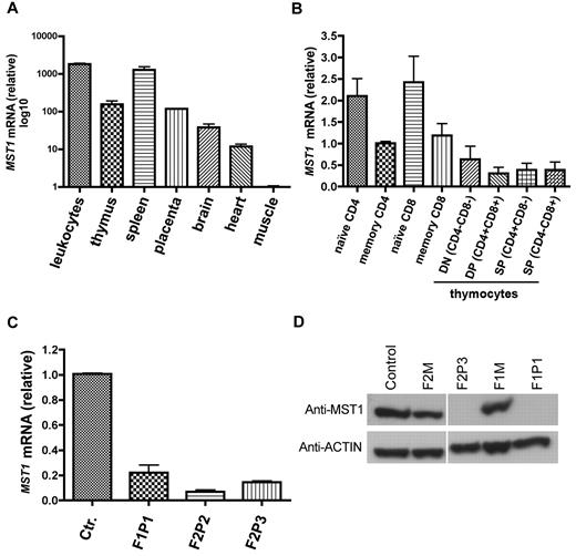 Figure 2. MST1 expression. (A) MST1 transcript levels were quantified as the -fold difference of mRNA levels for MST1 normalized against the housekeeping gene ACTA1 (β-actin). Data are representative of 2 independent experiments performed in duplicate. (B) MST1 transcript levels were quantified as the -fold difference in mRNA levels for MST1 (normalized to ACTA1) in control sorted naive (CD4+ CD45RA+; CD8+ CD45RA+ CCR7+) and memory subpopulations of CD4 (CD4+ CD45RO+) and CD8 (CD8+ CD45RO+ CCR7−) T cells, as well as double-negative, double-positive, and single-positive thymocytes. Data are representative of 3 independent experiments performed in duplicate. (C) MST1 transcript levels in control and patient T cells. Data are representative of 5 independent experiments performed in duplicate. (D) A Western blot analysis of MST1 protein expression in lymphocytes from a healthy control, 2 heterozygous individuals (F2M, F1M), and 2 MST1-deficient patients with different homozygous nonsense mutations. Actin was used as the loading control. Data are representative of 5 independent experiments.