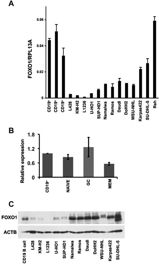 Figure 2. FOXO1 expression in B-cell subsets and in BCL cell lines. (A) Expression of FOXO1 mRNA in tonsillar CD19+ cells, cHL, BL, FL, DLBCL, and pre-BCL cell lines was assessed by quantitative RT-PCR as described in “Quantitative RT-PCR.” Data are mean ± SD of target gene to reference gene (FOXO1/RPL13A) ratio. (B) Expression of FOXO1 mRNA in B-cell subsets. The naive, GC, memory cells (MEM), and CD19+ cells were isolated from the fresh surgical material by magnetic cell sorting. The FOXO1 mRNA expression was measured by quantitative RT-PCR, and the data were analyzed by comparative Ct method. The figure represents mean of relative expression ± SD. (C) Expression of FOXO1 protein in human tonsillar CD19+ cells and in cHL cell lines. The proteins from samples of CD19+ cells and cultured lymphoma cell lines were separated by PAGE, and FOXO1 expression was assessed by immunoblot.