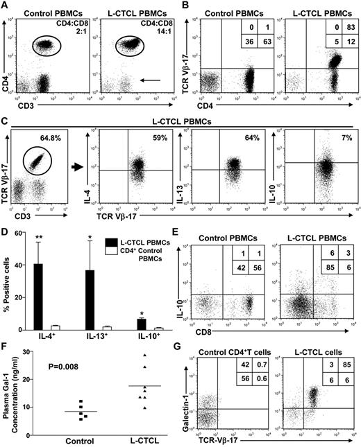 Figure 1. Patients with L-CTCL exhibit a contracted T-cell repertoire and Th2 cytokine profile. (A) PBMCs from patients with stage 4 CTCL or healthy controls (n = 3/group) were analyzed by flow cytometry. Representative plots show cells analyzed for CD3 and CD4 expression. Arrow indicates contraction of the CD3+/CD4− population. (B) Th cells from patients with stage 4 CTCL show increased expression of a single malignant TCR-Vβ clone. Representative plot is shown. (C) PBMCs from healthy controls or L-CTCL patients (n = 3/group) were stimulated ex vivo with PMA/ionomycin/brefeldin A, and intracellular levels of Th2 cytokines were analyzed by flow cytometry. Representative plot of L-CTCL patients is shown. (D) Graphical representation of data from all L-CTCL and health control donors depicting mean percentage of CD4+ cells expressing IL-4, IL-13, and IL-10. Statistically significant difference compared with healthy controls using Student paired t test: *P ≤ .05, **P ≤ .001. (E) PBMCs from healthy controls or L-CTCL patients were stimulated ex vivo with PMA/ionomycin/brefeldin A, and intracellular levels of IL-10 were analyzed in CD8+ T cells by flow cytometry. A representative plot is shown. (F) Graphical representation of undiluted plasma samples from patients with advanced-stage CTCL (triangles, n = 7) and healthy controls (squares, n = 5) were analyzed for Gal-1 expression by ELISA. Experiments were performed in triplicate. (G) PBMCs from L-CTCL patients or healthy controls were gated on CD3+/CD4+ and analyzed for specific TCR-Vβ expression and intracellular Gal-1. A representative plot is shown.
