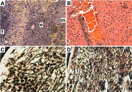 Figure 7. Subclinical myeloproliferative disease and myelofibrosis induced by JAK2V617F in the absence of STAT5. H&E stain of spleen (A) and liver (B) from a representative pIpC-treated recipient of JAK2V617F MIGFP-transduced Mx-Cre;Stat5a/bfl/− BM that engrafted with provirus-positive donor-derived HSCs. In the spleen, a lymphoid follicle (f) and areas of erythroid (e) and myeloid (m) cell infiltration are designated. Magnification is 200×. (C-D) Reticulin stain of BM from a non-pIpC–treated recipient of JAK2V617F MIGFP-transduced Mx-Cre;Stat5a/bfl/− BM that developed polycythemia (C) and a pIpC-treated recipient with normal hematocrit (D). Magnification is 600×. All images were obtained from a BH-2 microscope using a Q-Color5 digital camera and QCapture Pro acquisition software (Olympus).