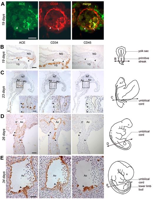 Figure 1. Expression of ACE in the human embryo. (A-B) Transverse sections of a 19-day human embryo. (A) In the extraembryonic YS, ACE/BB9 (green) and CD34 (red) are expressed in the hemangioblastic structures, blood islands (arrows), and in some endothelial cells bordering newly formed blood vessels (arrowheads). (B) In the embryo proper, ACE marks rare cells scattered in the caudal portion of the splanchnopleura (arrows). No co-localization of the CD34 or CD45 Ags is observed in these ACE+ cells. (C-D) Cross-sections through 23- and 26-day human embryos. At these stages, ACE expression is limited to some migrating cells concentrated in the mesoderm of the dorsal mesentery, which surrounds the dorsal aorta (Ao), in the caudal portion of the embryo. These ACE+ cells express neither CD34 nor CD45 (arrowheads in the inset on the right, which represents a high magnification of the splanchnopleura dotted in panel C). At 26 days of development, some endothelial CD34+ cells, which border the lumen of the aorta, also express ACE (white arrowheads). (E) Cross-sections through the dorsal aorta in a 34-day embryo. ACE is expressed by hematopoietic CD34+CD45+ cell clusters associated with the endothelium on the ventral side of the aorta (arrowheads), as well as by surrounding endothelial CD34+ cells (white arrowheads). The diagrams on the right in panels B through E indicate the position of the respective sections. Scale bar in panel A represents 20 μm; and panels B through E, 50 μm. NG indicates neural groove; NT, neural tube.
