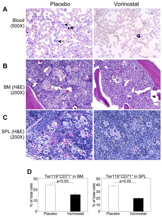 Figure 6. Histopathological characterization and flow cytometric analysis of BM and spleen of Jak2V617F knock-in mice treated with placebo or vorinostat. (A) Peripheral blood smears show normalization of RBCs and reticulocytes in vorinostat-treated Jak2V617F knock-in mice. Arrows indicate reticulocyte and immature nucleated RBCs. H&E staining of BM (B) and spleen (C) sections from placebo-treated Jak2V617F knock-in mice show hypercellularity with trilineage hyperplasia, which was markedly reduced by vorinostat treatment. (D) Percentage of erythroid precursors, determined by Ter119+ and CD71+ cells, was significantly reduced in both the BM and spleens of Jak2V617F knock-in mice treated with vorinostat compared with those of placebo-treated mice. Results shown represent means ± SEM from 7 mice in each group.