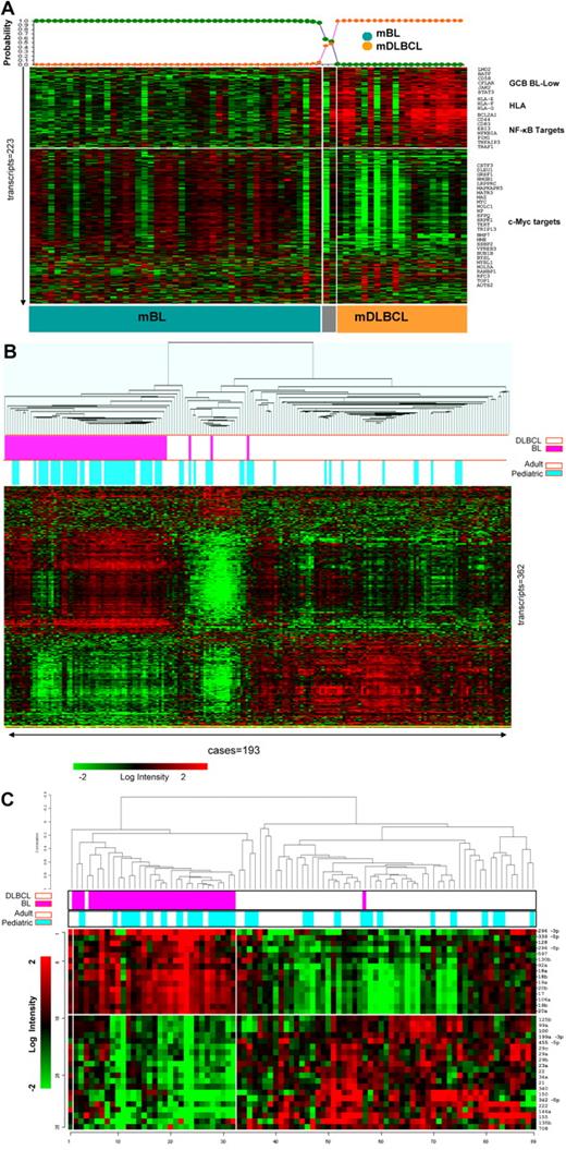 Figure 1. Gene expression profiling of BL and DLBCL. (A) Molecular classification of pediatric lymphomas using the Bayesian compound covariate predictor method and a published gene signature that distinguishes BL from DLBCL.15 GEPs of adult lymphomas used to derive this signature were used as a training (GEO accession no. GSE4732) dataset for the Bayesian predictor. Pediatric lymphomas with a probability ≥ 90% were classified accordingly. (B) Hierarchical clustering of adult (n = 21) and pediatric (n = 49) BL and adult (n = 102) and pediatric (n = 21) DLBCL cases using the gene expression signature used in panel A demonstrated robust distinction of BL and DLBCL regardless of patient age. Pediatric and adult specimens intermingled and did not form distinct subclusters. (C) Hierarchical clustering of BL and DLBCL using 35 significantly differentially expressed miRNAs between BL and DLBCL. Cases clustered by entity regardless of patient age. Two adult DLBCL cases clustered with BL and one pediatric BL case clustered with DLBCL. A separate cluster of DLBCL (far right) demonstrated high expression of both the BL and DLBCL signatures.