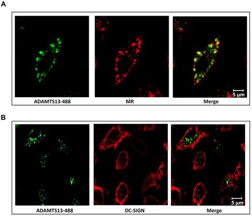 Figure 6. Colocalization of intracellular ADAMTS13 and MR in iDCs. MR mediates endocytosis of ADAMTS13. iDCs were incubated with ADAMTS13-488 for 45 minutes at 37°C. Subsequently, samples were fixed and labeled for MR (A) or DC-SIGN (B) and analyzed by confocal microscopy. (A) Colocalization of ADAMTS13 (green) with MR (red) was observed (merge). (B) Labeling of DC-SIGN (red) showed no colocalization with ADAMTS13 (green).