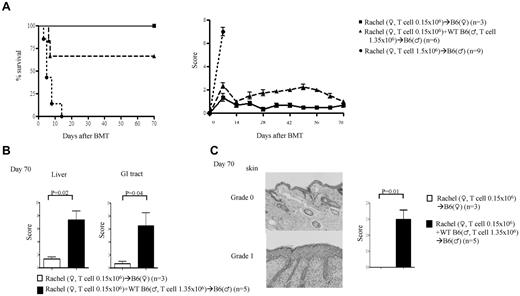 Figure 2. Donor T-cell precursor frequency is critical for induction of GVHD. Rachel T cells were transplanted along with TCD BM from B6♀ donors into lethally irradiated syngeneic B6♀ or allogeneic B♂ animals. The recipients were monitored for (A) survival and GVHD score. (B) Histopathology scores for liver and GI tract. (C) Skin H&E (left) and score (right). Data are from 1 of 3 similar experiments.
