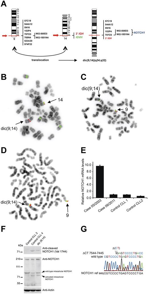 Figure 1. Genetic and molecular analysis of NOTCH1 aberrations. (A) Graphic representation of dic(9;14)(q34;q32) with indicated probes applied for FISH mapping of both breakpoints and their hybridization pattern. (B-D) Examples of FISH analysis performed on a diagnostic LN sample with (B) LSI IGH dual color break apart probe and CEP12 (green), (C) RP11-707O3 (green) and RT11-769N4 (red), (D) WI2-569D3 (G248P80019F4, green) and WI2-1851N4 (G248P8957B2, red). BAC and fosmid clones were selected using the UCSC Genome Browser on Human May 2004 (NCBI35/hg17) Assembly. Note in panel B the presence of the 3′IGH/red signal on dic(9;14) and loss of the distal IGVH/green signal in cell with trisomy 12, in panel C hybridization of RP11-707O3 (green) with dic(9;14) and loss of the distal RT11-769N4 (red) sequences, and in panel D hybridization of both fosmids covering NOTCH1 with dic.(9;14). (E) qRT-PCR analysis of NOTCH1 mRNA expression levels. The patient was analyzed at 2 different timepoints, at diagnosis (05/2003; PBL; 57% of cells with dic(9;14)) and during disease evolution (06/2011; PBL; dic(9;14)-negative), and relative NOTCH1 expression levels were compared with 2 control CLL samples (CLL1 and CLL2) with unmutated VH and trisomy12. (F) Western blot analysis of protein extract of diagnostic LN cells of the index case (15% of cells with dic(9;14)) and 2 control CLLs (unmutated VH, trisomy12); CLL3 with unmutated NOTCH1 and CLL4 positive for ΔCT7544-7545/P2515fs. The top panel shows detection of active, cleaved NOTCH1 (Val 1744 antibody; Cell Signaling Technology) in CLL4 and the index case, but not in CLL3 cells. The bottom panel shows expression of NOTCH1 with a general anti-NOTCH1 antibody (c-20 Santa Cruz Biotechnology). Because of a low content of cells with dic(9;14) in the only available LN sample, overexpression of an activated form of NOTCH1 could not be evidenced. (G) Sanger chromatogram illustrating a heterozygous ΔCT7544-7545/P2515fs of the NOTCH1 cDNA in the diagnostic BM sample. FISH images acquired with a 63×/1.4 oil immersion objective in an Axioplan 2 fluorescence microscope equiped with an Axiophot 2 camera (Carl Zeiss) and an Isis imaging system (MetaSystems). Images were imported directly into PowerPoint (Microsoft).
