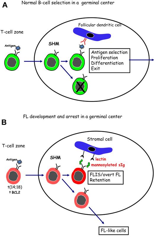 Figure 1. Surface Ig-mediated events occurring in normal B cells or in FL B cells after entry into the GC. (A) Normal B cells encounter antigen in the T-cell zone and then locate in a GC where SHM, antigen selection, and isotype switching occur. Antigen, held as immune complexes on follicular dendritic cells, selects B cells of appropriate affinity. After interaction with specific T cells, selected B cells proliferate and differentiate before leaving the site to develop into memory B cells or plasma cells. (B) B cells that have undergone the t(14;18) translocation can respond to antigen and undergo SHM in a GC. Introduced N-glycosylation motifs in the Ig variable regions are positively selected by FL cells. Interaction of the added mannoses with lectins can occur and might provide a foundation for development of FLIS or overt FL in the GC site. B cells that do not acquire N-glycosylation motifs can exit, and possibly revisit, the GC.
