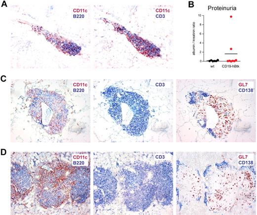 Figure 4. Aging CD19-hBtk mice have large perivascular infiltrates in various organs. (A) Immunohistochemical analysis for dendritic cells (CD11c+, red) and B cells (B220+, blue; left panel) or T cells (CD3+, blue; right panel) of kidney tissue sections from old CD19-hBtk mice (objective 10×). (B) Proteinuria in 2 of 8 (25%) CD19-hBtk mice; albumin levels in urine samples were measured by ELISA. (C-D) Immunohistochemical analysis for dendritic cells (CD11c+, red) and B cells (B220+, blue; left panel), T cells (CD3+, blue; middle panel), or GC B cells (GL7+, red) and plasma cells (CD138+, blue; right panel) of lungs (C) and salivary glands (D) from old CD19-hBtk mice (objective 10×). Data are representative of 5-8 CD19-hBtk mice.