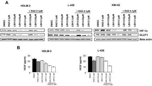 Figure 6. Effects of panobinostat (LBH589) and everolimus (RAD001) combination on angiogenesis and glucose metabolism. (A) Cells were incubated with diluent control, LBH589 (0.02-0.1μM), RAD001 (0.1μM), or the combination of LBH589 and RAD001; and after 48 hours, cell lysates were prepared and resolved by SDS-PAGE, transferred to nitrocellulose membrane, and probed with anti–HIF-1α and anti-GLUT1 antibodies. (B) Cells were incubated with diluent control or LBH589 (0.02-0.1μM), RAD001 (0.1μM), or the combination of LBH589 and RAD001; and after 48 hours, supernatants were examined for VEGF levels using a multiplex assay. Each value represents a mean of 3 independent experiments ± SEM performed in triplicate.