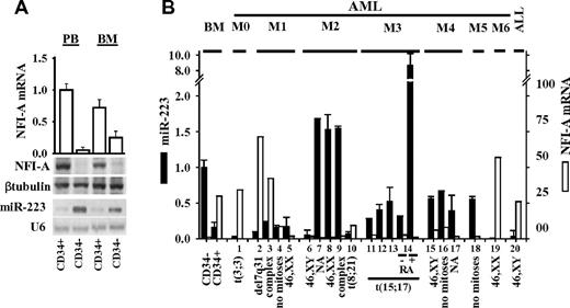 Figure 1. miR-223 and NFI-A mRNA/protein levels in human hematopoietic cells and leukemias. (A) Quantitative RT-PCR of NFI-A mRNA level (□), Northern blot analysis of miR-223 expression, and immunodetection of NFI-A protein in CD34+ HSC/HPCs and CD34− cells from PB or BM. U6 and β-tubulin were probed as RNA and protein loading controls, respectively. (B) Quantitative RT-PCR of miR-223 (■) and NFI-A (□) mRNA expression levels in leukemia patient samples classified by FAB.24 ALL indicates acute lymphocytic leukemia; and NA, not available. Genetic features of leukemia blasts are indicated. Quantitative RT-PCR data are represented as mean ± SD of 3 independent evaluations.