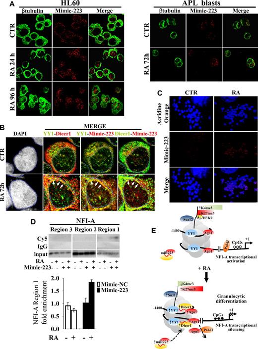 Figure 6. Cellular localization and colocalization of miR-223, YY1, and Dicer1. HL60 cells and primary APL blasts were treated or not (CTR) with 1μM RA for the indicated times and analyzed by immunofluorescence confocal microscopy. (A) Localization of miR-223–Mimic-Cy5 (Mimic-223) in HL60 cells and in APL blasts, β-tubulin marking cell cytoplasm, and the merge of the 2 channels. (B) Colocalization of Mimic-223, YY1 (AlexaFluor-488), and Dicer1 (AlexaFluor-555). Quadruple labeling (DAPI, YY1, Dicer1, Mimic-223) and double-channel visualization of untreated (CTR) or treated (RA) HL60 cells. Channel colors were palette assigned. A mask landmark (blue line) delineates the nuclear boundaries, and white arrows indicate areas of higher colocalization (yellow dots). (C) Acridine Orange-stained mitotic chromosomes, localization of 223-Mimic-Cy5 (Mimic-223), and the merge of the 2 channels. (D) ChIP assay performed on HL60 cells transiently transfected (+) or not (−) with Cy5-Mimic-223 and treated (+) or not (−) with 1μM RA for 48 hours. Chromatins were immunoprecipitated with an anti-Cy5 antibody. NFI-A regions 1, 2, and 3 were PCR amplified and visualized by 32P-labeled oligonucleotides (supplemental Table 5) as described in supplemental Methods or by quantitative RT-PCR measuring Mimic-223 or Mimic-NC enrichment at NFI-A region 1 (bottom panel). Error bars represent SD of 3 independent evaluations. (E) Schematic model for the heterochromatic silencing of NFI-A gene by PcG-miR-223 complexes in RA-induced granulocytic differentiation. In undifferentiated HL60 cells (top panel), YY1 is present at low levels, with Suz12 and Ago1 at its binding sites on NFI-A promoter, and this correlates with an enrichment (↑) in active chromatin marks (acH3, H3K4me3), decreased (↓) repressive/inactive mark H3K27me3, demethylated CpGs (○), recruitment of RNAPol-II, and NFI-A transcriptional activation. On RA-induced granulocytic differentiation (bottom panel), miR-223 localizes in the nucleus and via the formation of a Dicer1/Ago1-YY1/Suz12 complex, miR-223 targets its complementary DNA sequences flanking YY1 binding sites on NFI-A promoter at a distance of approximately 1 nucleosome. The increased occupancy of the PcG-miR complexes at these sites correlated with a decrease in active H3K4me3 and an enrichment in repressive/inactive mark H3K27me3, CpG methylation (●), transcriptional silencing of NFI-A gene, and granulocytic differentiation of myeloid precursors. Numbers are the nucleotides relative to the start site of the NFI-A gene (+1).