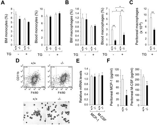Figure 1. G6pc3−/− macrophages exhibit impaired trafficking in vivo. Macrophages were isolated from 6- to 8-week-old wild-type (+/+) and G6pc3−/− (−/−) littermates. Monoctyes (SSCloGr-1−/lo/+/CD11b+) and macrophages (F4/80+/CD11b+) were analyzed by flow cytometry. (A) BM and blood monocyte counts in wild-type (n = 8) and G6pc3−/− (n = 8) mice in the absence and presence of thioglycollate (TG). (B) BM and blood macrophage counts in wild-type (n = 8) and G6pc3−/− (n = 8) mice in the absence and presence of TG. (C) The total peritoneal macrophage counts in wild-type (n = 8) and G6pc3−/− (n = 8) mice challenged with TG. (D) Flow cytometric analysis of peritoneal macrophages in control and G6pc3−/− mice and Hema 3-stained cytospins of peritoneal macrophages at magnification of ×400. (E) Quantification of MCP-1 and M-CSF mRNA in peritoneal macrophages by real-time RT-PCR. Expression is normalized to β-actin and measured relative to one wild-type mouse arbitrarily defined as 1. (F) The levels of MCP-1 and M-CSF in peritoneal exudates of wild-type (n = 8) and G6pc3−/− (n = 8) mice after intraperitoneal injection of TG. Data represent the mean ± SEM. **P < .005 and *P < .05.
