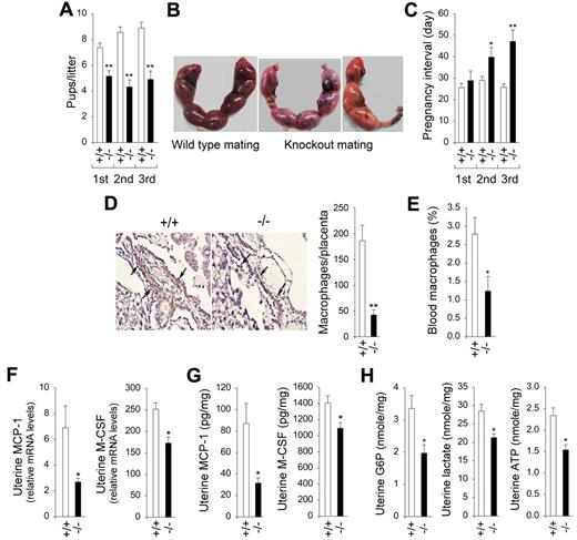 Figure 5. G6pc3−/− mice exhibit reduced fertility. (A-C) Pup size and pregnancy intervals in wild-type and knockout matings. Sixteen pairs of wild-type and 16 pairs of knockout matings were set up with 8- to 10-week-old unaffected (+/+) and G6pc3−/− (−/−) littermates. The pregnancy outcome was examined for 3 consecutive pregnancies. (A) The litter size. (B) Representative placentas at gestation day 15 in wild-type and knockout matings. (C) The intervals between the first 3 serial pregnancies. Values represent mean ± SEM. Data were measured for each pregnancy. (D) Representative IHC analysis of macrophages in the decidual region of the gestation day 15 placenta in wild-type (n = 8) and G6pc3−/− (n = 8) matings at magnifications of ×400 and quantification of macrophage counts. Values represent mean ± SEM. Arrows denote macrophages. In wild-type placenta, numerous macrophages accumulated along the deciduas, and in G6pc3−/− placenta few macrophages were seen. (E) Blood macrophage counts in wild-type (n = 8) and G6pc3−/− (n = 8) mothers at gestation day 15, expressed as a percentage of total white blood cells. (F) Quantification of uterine MCP-1 and M-CSF mRNA in wild-type (n = 8) and G6pc3−/− (n = 8) mothers at gestation day 15 by real-time RT-PCR. Levels are expressed as a ratio of uterine tissue to peritoneal macrophages. (G) Quantikine ELISA analysis of the levels of uterine MCP-1 and M-CSF in wild-type (n = 8) and G6pc3−/− (n = 8) mothers at gestation day 15. (H) Uterine G6P, lactate, and ATP levels in wild-type (n = 8) and G6pc3−/− (n = 8) mothers at gestation day 15. Data represent the mean ± SEM. **P < .005 and *P < .05.