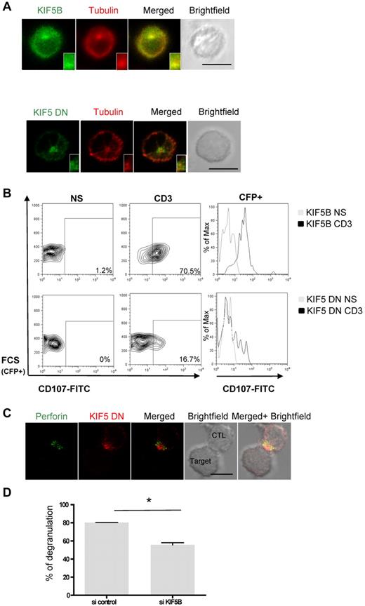 Figure 3. Kinesin-1 controls the terminal transport of lytic granules after granule polarization. (A) Top panel: confocal microscopy of CTLs transfected with GFP-KIF5B. Cells were fixed, permeabilized, and stained with anti-tubulin (red). Bottom panel: confocal microscopy of CTLs transfected with GFP-KIF5 DN and stained with anti-tubulin (red). The insets represent an enlarged image. Scale bars represent 5 μm. All images of single cell were representative of > 60 cells observed over at least 4 independent experiments performed in duplicate. (B) Lak cells were transfected with CFP-KIF5B or CFP-KIF5 DN. Transfected cells were incubated for 3 hours alone or with a coated anti-CD3 antibody in the presence of anti-CD107a–FITC and anti-CD107b–FITC antibodies. Thereafter, cells were stained with anti-CD3–PE and anti-CD8–APC antibodies. Lymphocytes were gated on CD3+CD8+ cells. Profile shows CFP versus CD107-FITC gating on CD3+CD8+ CTLs. For each condition, a histogram overlay analysis of Lamp secretion by CFP+ cells was performed. Each condition is representative of 3 independent experiments performed in duplicate. (C) Confocal microscopy of CTLs transfected with mCherry-KIF5 DN and conjugated with L1210 target cells. Cells were then fixed, permeabilized, and stained with anti-perforin antibody (green). Scale bars represent 5 μm. All images of conjugates were representative of > 90 cells observed over at least 3 independent experiments performed in triplicate. (D) CTLs cotransfected with CFP and siRNA control or siRNA targeting KIF5B were incubated for 3 hours alone or with a coated anti-CD3 antibody in the presence of CD107a and CD107b antibodies. CFP+ cells were analyzed for Lamp secretion and shown in a representative histogram of 3 independent experiments. Statistical analysis was performed by Mann-Whitney test. *P < .05.