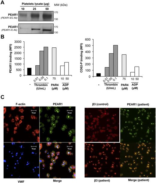 Figure 1. PEAR1 in the platelet membrane and in α-granules. (A) Western blot of lysate from resting platelets, revealing PEAR1 by antibodies against the extracellular (PEAR1-EC Ab, upper lanes) and intracellular (PEAR1-IC Ab, lower lanes) domains, for the indicated amounts of loaded protein. (B) Flow cytometric measurement as mean fluorescence intensity (MFI) of PEAR1 and P-selectin (CD62-P) on the membrane of resting washed platelets and platelets stimulated with thrombin, PAR4-activating peptide (PAR4) and ADP, at the indicated concentrations. Data shown represent one experiment, representative of at least 3 analyses. (C) Confocal immunofluorescence microscopy of human platelets spread over a fibrinogen matrix; left panel: stained with rhodamin-phalloidin (F-actin, red), and labeled for PEAR1 (green), and VWF (blue) and for the colocalization of PEAR1/VWF (cyan), PEAR1/actin (yellow), and PEAR1/VWF/actin (white). Bar, 10 μm. Original magnification ×630; right panel: human platelets (control and uncharacterized-secretion defective patient platelets) spread over a fibrinogen matrix, labeled for β3 integrin (red) and for PEAR1 (green). Original magnification ×400.