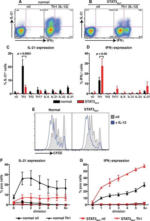 Figure 4. STAT3 mutations impair IL-12–induced expression of IL-21 in naive CD4+ T cells. (A-D) Naive CD4+ T cells isolated from healthy donors (n = 8) and STAT3MUT patients (n = 9) were cultured for 5 days under neutral conditions (nil); polarizing Th1, Th2, or Th17 conditions; or in the presence of IL-6, IL-21, IL-23, or IL-27, after which time expression of intracellular IL-21 and IFNγ was determined. (A-B) Representative dot plots of cytokine expression by activated naive CD4+ T cells from 1 donor and 1 patient. (C-D) Percentage of activated normal and STAT3MUT naive CD4+ T cells induced to express (C) IL-21 or (D) IFNγ in response to the indicated culture. The values represent the mean ± SEM. (E-F) Naive CD4+ T cells isolated from healthy donors and STAT3MUT patients were labeled with CFSE and cultured with anti-CD2/CD3/CD28 Abs in the absence (nil) or presence of Th1 polarizing conditions (+IL-12). After 5 days cells were harvested, and (E) proliferation and expression of (F) IL-21 and (G) IFNγ in cells that had undergone different divisions were then determined. (F-G) The values represent the mean ± SEM (n = 3).