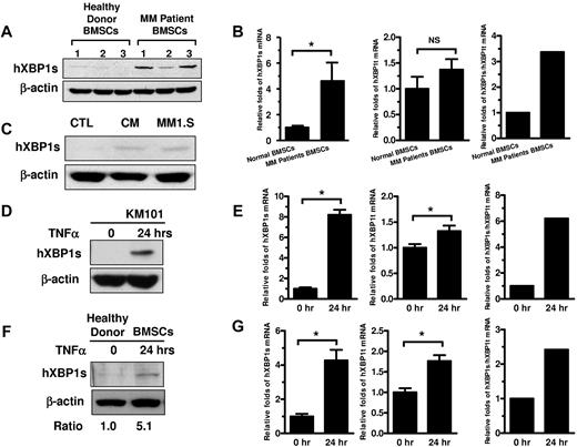Figure 1. XBP1s is induced in MM patient BMSCs and TNF-α induces XBP1s up-regulation in healthy hBMSCs. (A) Western blot demonstrating XBP1s protein levels in primary BMSCs from MM patients and healthy donors. (B) Real-time PCR analysis demonstrating mRNA levels of Xbp1s (left), total Xbp1 (middle), and mRNA splicing of total Xbp1 (right) in the BMSCs of MM patients and healthy donors. The latter was determined as the ratio of Xbp1s to total Xbp1 mRNA levels (n = 3; mean ± SD; *P < .05; NS indicates not statistically significant). (C) Western blot demonstrating XBP1s protein levels in healthy donor BMSCstreated with MM1.S CM or cocultured with MM1.S cells (MM1.S). (D) Western blot demonstrating the effects of TNFα (10 ng/mL for 24 hours) on XBP1s protein levels in human BMS cell line KM101. (E) Real-time PCR results demonstrating the effects of TNFα (10 ng/mL for 24 hours) on mRNA levels of Xbp1s and total Xbp1 and mRNA splicing of total Xbp1 in KM101 cells (n = 3; mean ± SD; *P < .05). (F) Western blot demonstrating the effect of TNFα (10 ng/mL for 24 hours) on XBP1s protein levels in healthy donor BMSCs. (G) Real-time RT-PCR results demonstrating the effects of TNFα (10 ng/mL for 24 hours) on mRNA levels of Xbp1s and total Xbp1 and splicing of total Xbp1 mRNA in healthy donor BMSCs (n = 3; mean ± SD; *P < .05).