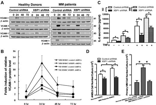 Figure 5. Knock-down of XBP1 in hBMSCs compromises their support of MM cell growth. (A) Western blot demonstrating the effects of XBP1 knockdown on the baseline and TNFα-induced VCAM-1 protein expression in BMSCs from 3 independent healthy donors and 4 independent MM patients. (B) A schematic quantitative representation of Western blot results shown in panel A. The VCAM-1 protein levels were normalized to those of β-actin. The baseline relative VCAM-1 protein levels of the healthy donor BMSCs in the absence of hXbp1 shRNA are arbitrarily defined as 1. Error bars represent means ± SD. (C) Effects of XBP1 knockdown on the baseline and TNFα-induced IL-6 secretion in the condition medium of both healthy donor and MM patient BMSCs as determined by ELISA (n = 3, mean ± SD, *P < .05). (D-E) Effects of XBP1 knockdown on the capacity of healthy donor and MM patient BMSCs to support the growth of human ANBL6 cells (D) or primary human MM cells (E; n = 3, mean ± SD, *P < .05).