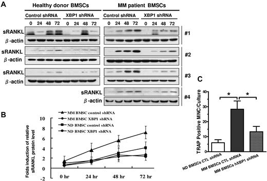 Figure 6. Knockdown of XBP1 in BMSCs compromises BMSC secretion of RANKL and support of OCL formation. (A) Western blot demonstrating the effects of XBP1 knockdown on the baseline and TNFα-induced sRANKL protein levels in the total lysates of the BMSCs of both healthy donors (n = 3; left) and MM patients (n = 4; right). β-actin served as the loading control. (B) Schematic quantitative representation of results shown in panel A. The sRANKL protein levels were normalized to those of β-actin. The baseline relative sRANKL protein levels of the healthy donor BMSCs in the absence of hXbp1 shRNAs are arbitrarily defined as 1. Error bars represent means ± SD. (C) Effect of XBP1 knockdown on the capacity of MM patient BMSCs to support OCL formation (n = 3; mean ± SD; *P < .05).