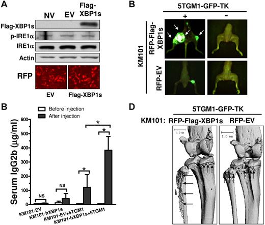 Figure 7. hXBP1s overexpression in BMSCs enhances their support of MM cell growth and bone resorption in vivo. (A) Western blot demonstrating that lentiviral infection of Flag-hXBP1s led to enhanced expression of hXBP1s in KM101 cells. EV-expressing lentiviruses did not induce endogenous XBP1s protein level and phosphorylation of IRE1α in the KM101 cells (top). RFP fluorescence images indicate high infection efficiency (bottom). (B) Overexpression of XBP1s in KM101 cells enhanced MM cell growth in SCID mice. The tumor growth at 4 weeks after injection was reflected by fluorescence imaging of GFP. White arrows indicate MM tumor masses formed by the injected 5TGM1-GFP-TK cells. One of 4 representative mice is shown for each group. (C) ELISA analyses demonstrating the serum concentrations of IgG2b in the injected SCID mice before and after cell injections at 4 weeks after injection (n = 3; mean ± SD; *P < .05. NS indicates not statistically significant. (D) μQCT analysis demonstrating more severe and extensive osteolytic lesions in the SCID mice with XBP1s-KM101 cells plus GFP-5TGM1 cells compared with those with EV-KM101 plus GFP-5TGM1 cells. Black arrows indicate bone destruction.