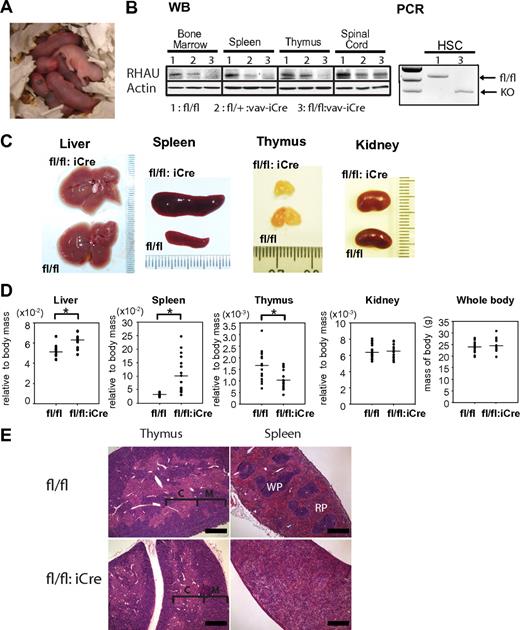 Figure 1. Phenotypes of RHAUfl/fl:vav-iCre mice. (A) Anemic appearance of newborn RHAUfl/fl:vav-iCre mice with specific RHAU ablation in the hematopoietic system. (B left) Western blot (WB) analysis of the efficiency of RHAU ablation in hematopoietic organs. (B right) Genotype analysis of HSCs by PCR. HSCs were sorted by FACS as described in “FACS analysis” (supplemental Table 1). The genotypes of mice are (1), RHAUfl/fl; (2), RHAUfl/+:vav-iCre; and (3), RHAUfl/fl:vav-iCre. (C) Liver, spleen, thymus, and kidney of RHAUfl/fl:vav-iCre and control RHAUfl/fl mice. (D) Total body mass and relative body mass of each organ from RHAUfl/fl:vav-iCre and RHAUfl/fl mice. Each dot represents the relative body mass expressed as the ratio of organ weight to total body weight. *P < .05; n = 16. (E) H&E staining of spleen and thymus from RHAUfl/fl and RHAUfl/fl:vav-iCre mice (magnification, ×4; bar, 500 μm). RHAUfl/fl and RHAUfl/fl:vav-iCre are presented as fl/fl and fl/fl:iCre in figures, respectively.