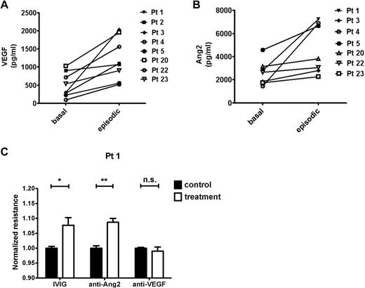 Figure 6. Permeability-modifying factors in SCLS. (A-B) Comparison of basal and episodic VEGF or Ang2 in individual patients with SCLS. (VEGF: P = .015; Ang2: P = .008, Wilcoxon signed rank test). (C) The barrier-defending roles of IVIG, anti-Ang2 (Tie2-Fc), and anti-VEGF (bevacizumab) or equivalent concentrations of control IgG (for anti-Ang2 and bevacizumab) or BSA (for IVIG) against episodic sera from 4 to 6 patients was evaluated in the TEER assay. Shown is the response to the episodic sera of patient 1 (n = 3-5 replicates per condition). *P < .05 and **P < .01.