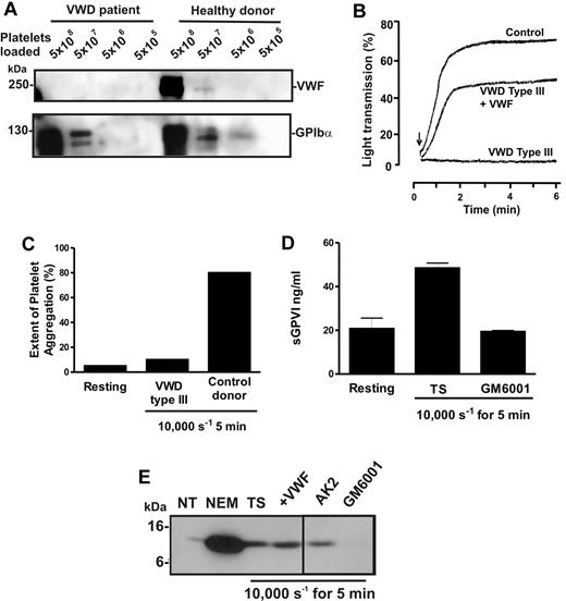 Figure 4. Shear-induced shedding of GPVI occurs in the absence of VWF. Citrated PRP or washed platelets were prepared from blood isolated from a patient with VWD type 3 or a healthy donor. (A) To assess levels of VWF and GPIbα in each sample, equivalent concentrations of washed platelets were lysed in nonreducing sample loading buffer and subjected to SDS-PAGE and Western blot using 1 μg/mL anti-VWF mAb, 6G1 (top panel) or 1 μg/mL anti-glycocalicin antibody (bottom panel). (B) To assess VWF function, citrated PRP from the same patient or a healthy donor was subjected to ristocetin-induced platelet aggregation using light transmission aggregometry. Arrow indicates the time at which 1.5 mg/mL ristocetin was added. Absent ristocetin-induced aggregation in the patient sample was rescued by inclusion of 10 μg/mL purified VWF before addition of ristocetin. (C-D) Citrated PRP from the patient or a healthy donor was subjected to 10 000-second−1 shear for 5 minutes, and samples were then analyzed for (C) platelet aggregation by particle counting or (D) sGPVI levels by ELISA. (E) VWD type 3 washed platelets were either left untreated (NT) or treated for 15 minutes with 5mM NEM, or exposed to 10 000 seconds−1 shear for 5 minutes in the presence of TS buffer alone, or containing 10 μg/mL AK2, 10 μg/mL purified VWF, or 100μM GM6001. Samples were then lysed in nonreducing sample loading buffer and subjected to SDS-PAGE and Western blot using 1 μg/mL anti-GPVI cytoplasmic tail antibody. A vertical line indicates a repositioned lane.