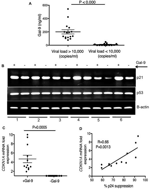 Figure 4. Elevation of Gal-9 in plasma of HIV+ individuals and up-regulation of p21 in CD4+ T cells after stimulation with Gal-9. (A) Detected levels of plasma Gal-9 from 30 HIV+ individuals with a viral load of less or more than 10 000 copies/mL. (B) RT-PCR reflecting β-actin, p53, and p21 gene expression in activated CD4+ T cells stimulated with Gal-9 (1 μg/mL; +Gal-9) or in the absence of Gal-9 (−Gal-9) for 2 hours before total RNA isolation. (C) Quantitative CDKN1A mRNA fold expression from activated CD4+ T cells after stimulation with Gal-9 (1 μg/mL) for 2 hours in vitro compared with CDKN1A mRNA expression in CD4+ T cells in the absence of Gal-9 from the same individual. Significance was tested using Wilcoxon signed rank test. (D) Correlation between CDKN1A mRNA fold expression from CD4+ T cells in the presence of Gal-9 (1 μg/mL) and resistance to HIV-1 infection. Resistance to infection was measured by intracellular staining for viral p24 antigen using flow cytometry on CD4+ T cells infected with R5-tropic HIV-1 isolate in the presence of Gal-9 (1 μg/mL). Pearson correlation coefficient is shown. Data were obtained from 12 different individuals and each point represents 1 individual.