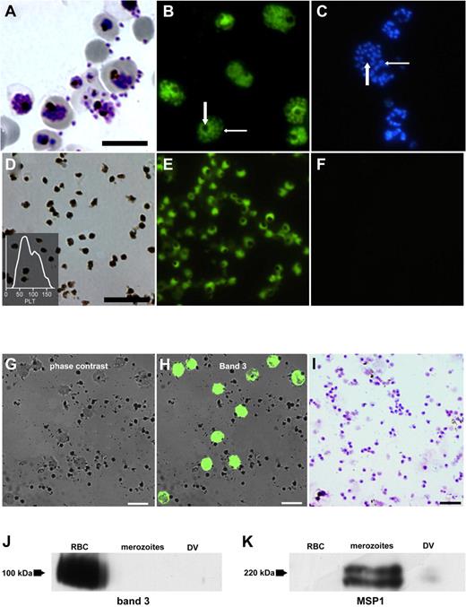 Figure 1. Differential staining of merozoites and DVs. (A) Giemsa stain of late-stage pRBCs undergoing schizont rupture. (B) Vital stain of the same culture with BCECF-AM showing intense staining of DVs (large arrow) alongside staining of merozoites (small arrow). (C) Same culture stained with Hoechst 33342, which detects merozoites (small arrow) but spares the DVs (large arrow). (D) Giemsa stain of isolated DVs. Insert shows the recording of analysis in a hemocytometer with DVs presenting as particles with the size of platelets (PLT). (E) Staining of isolated DVs with BCECF. (F) No staining with Hoechst 33342. (G) Phase-contrast image of DVs to which RBCs were added. (H) Same smear fluorescently stained for RBC band 3 protein. (I) Giemsa stain of purified merozoite preparation used in Western blots. (J) Western blots of RBC membranes, merozoites, and DVs probed with Abs against RBC band 3 protein and MSP1 (K). DV preparations contained very scant contaminations with MSP1. Arrows depict the positions of the respective molecular weight markers. Scale bars indicate 10 μm.